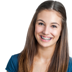 Cost of Braces in Atlanta & Marietta, GA